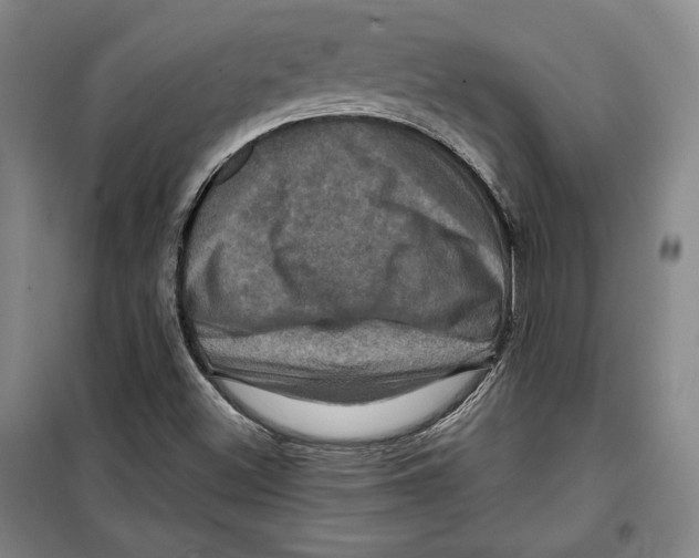 X0000099451500200806061054