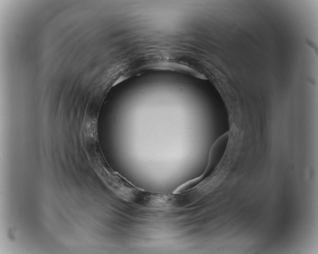 X0000099460096200805161057