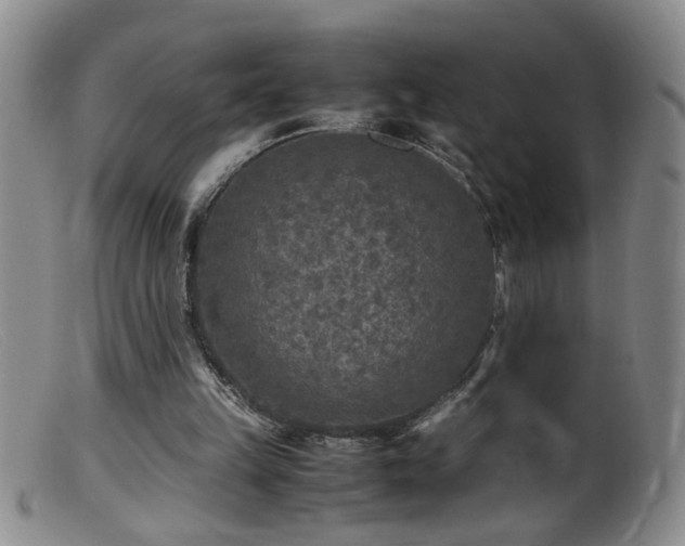 X0000099460149200805161055