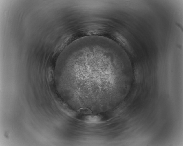 X0000099460169200805161056