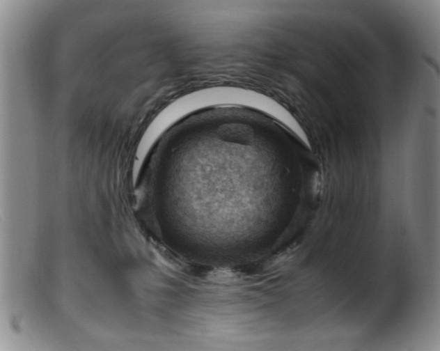 X0000099460231200805161055