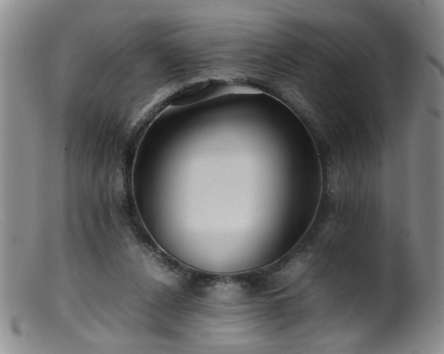 X0000099460256200805161054