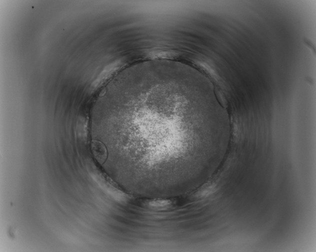 X0000099460357200805161052