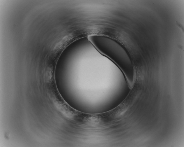 X0000099460546200805161049