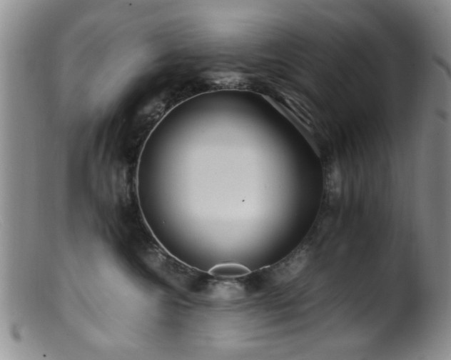 X0000099460572200805161050