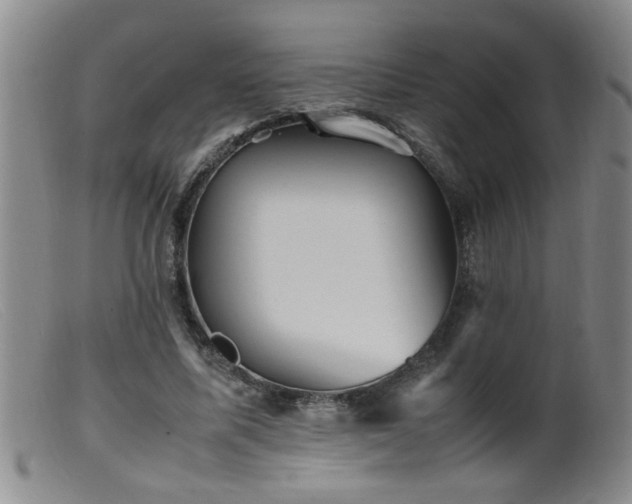 X0000099460587200805161049