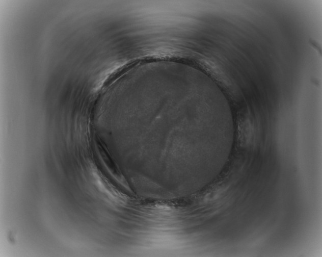 X0000099460592200805161049