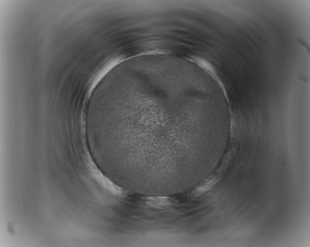 X0000099460859200805161045