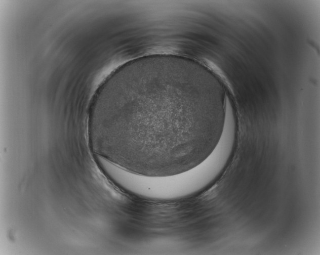 X0000099461035200805161042