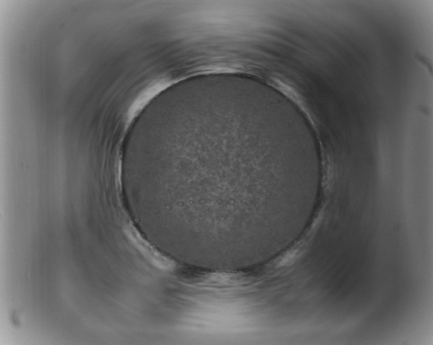 X0000099461179200805161039