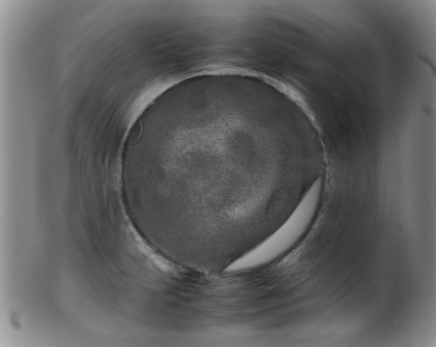 X0000099461231200805161039