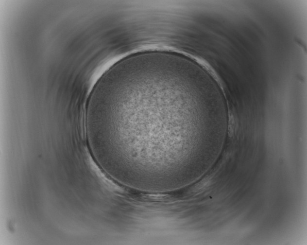 X0000099461295200805161038