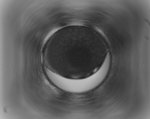 X0000099461323200805161037