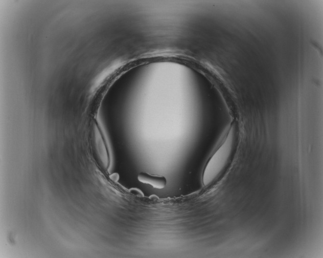 X0000099461406200805161036