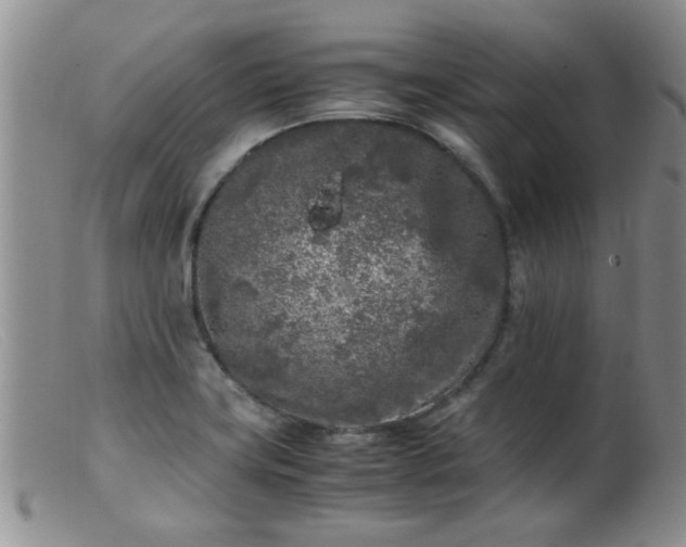 X0000099461419200805161036