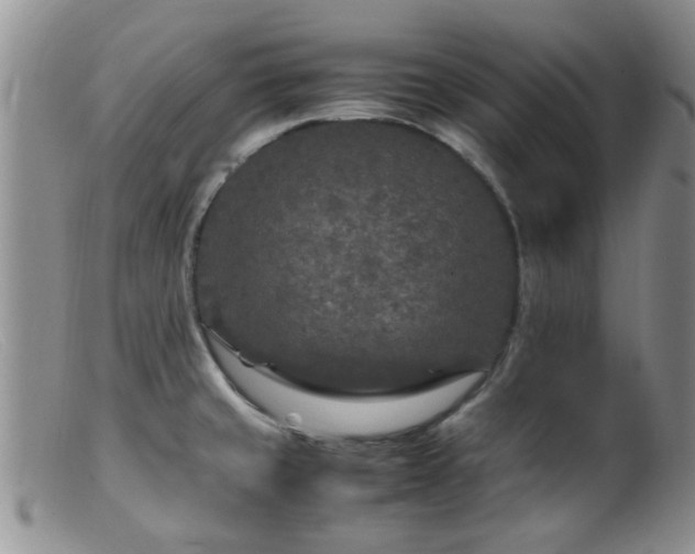 X0000099461429200805161036