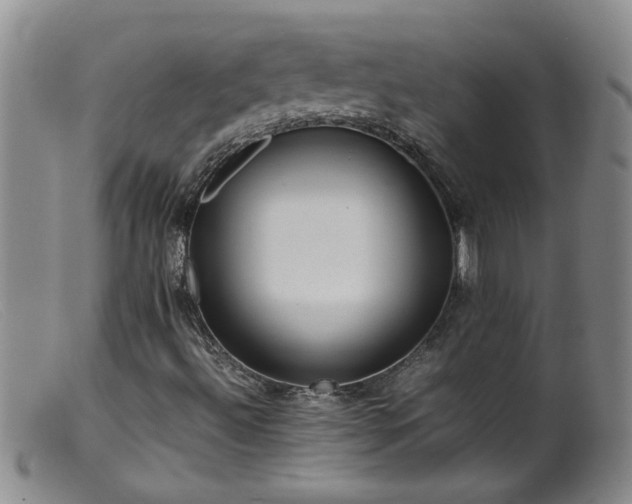 X0000099461492200805161033