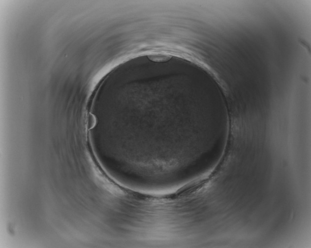 X0000099461522200805161034