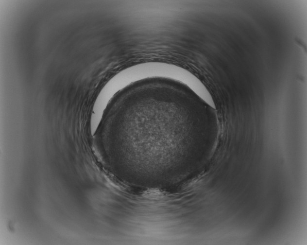 X0000099460231200805231814