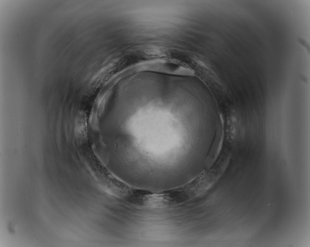 X0000099460320200805231812