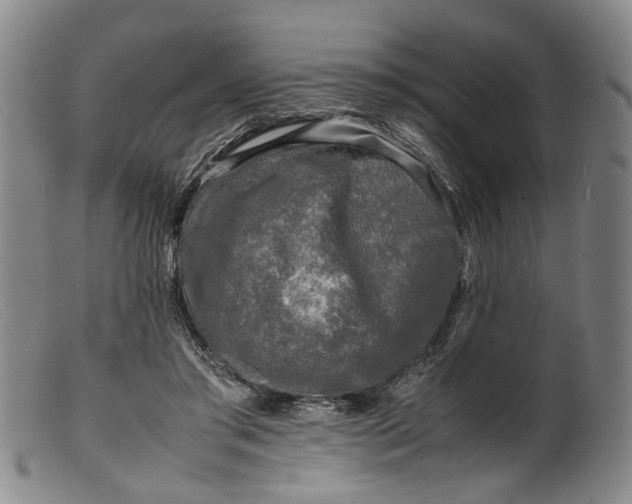 X0000099460405200805231811