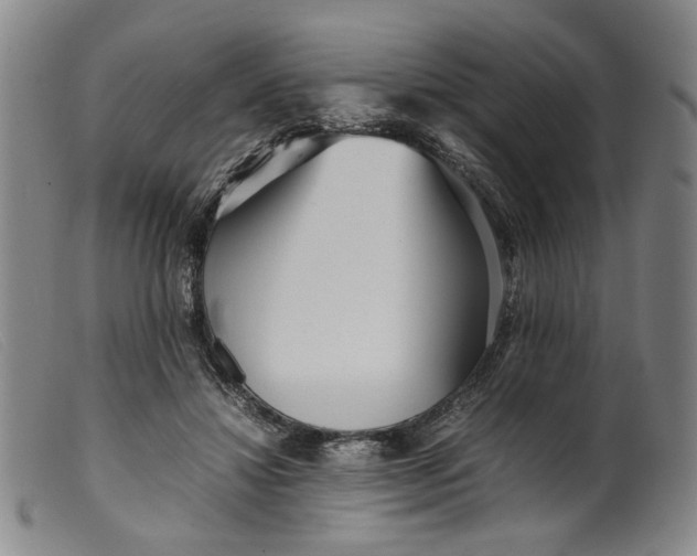 X0000099460452200805231810