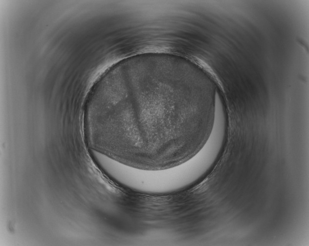 X0000099461035200805231801