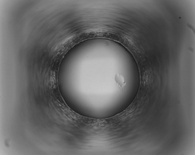 X0000099461062200805231801