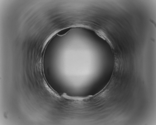 X0000099461100200805231800