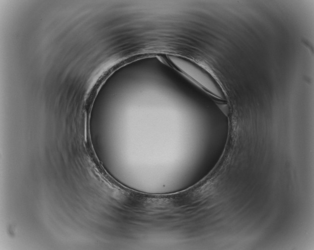 X0000099461123200805231800