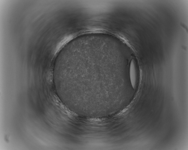 X0000099461405200805231755