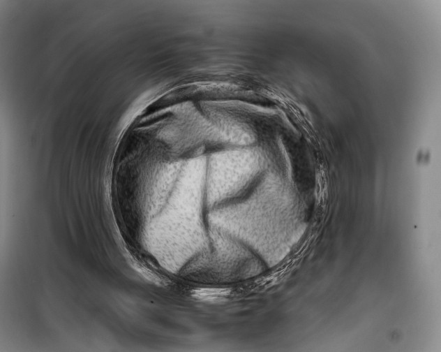 X0000099460051200805301543