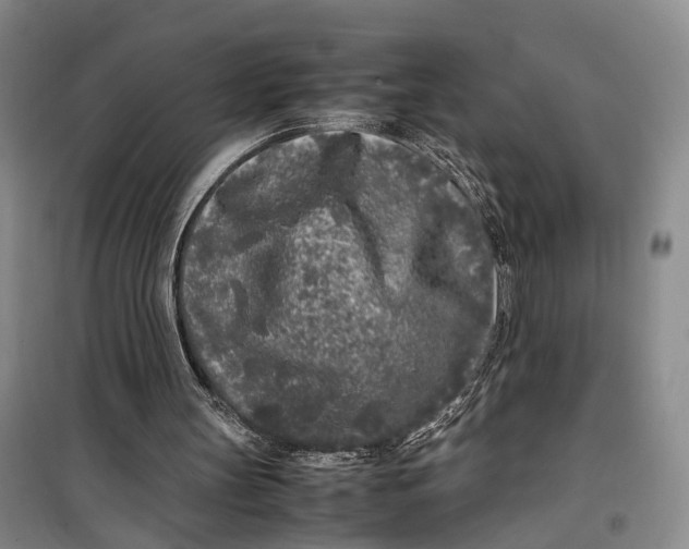 X0000099460147200805301541