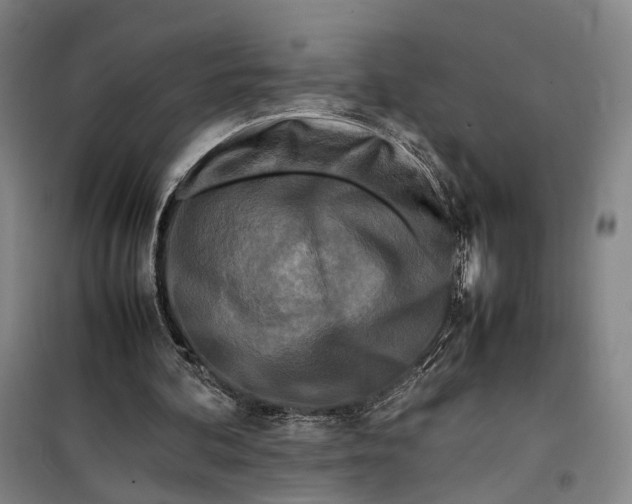 X0000099460292200805301540