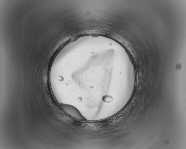 X0000099460297200805301540