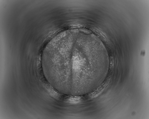 X0000099460369200805301539