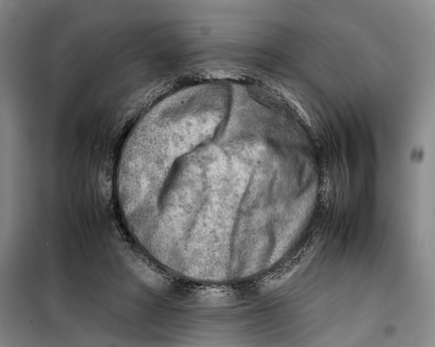 X0000099460402200805301539