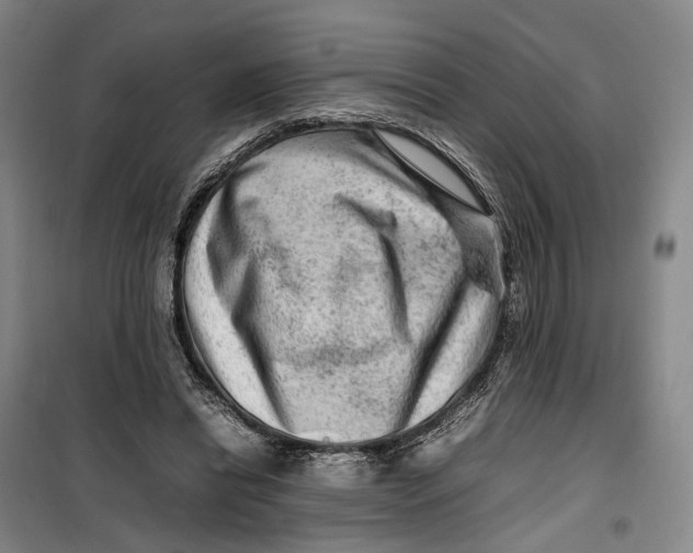 X0000099460446200805301538