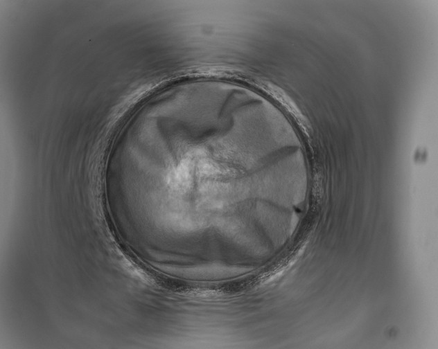 X0000099460577200805301536