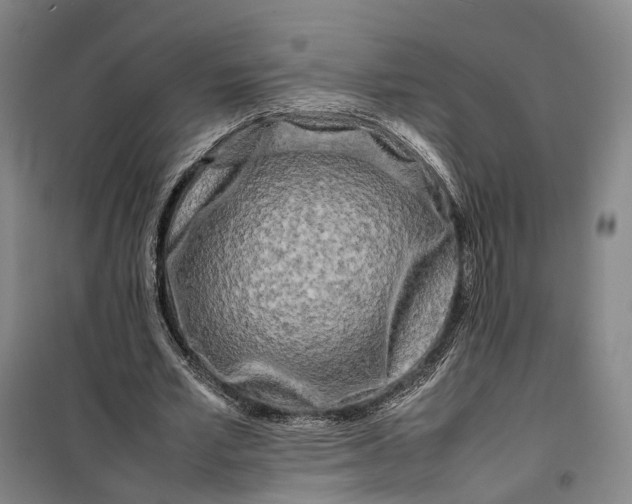 X0000099460581200805301536