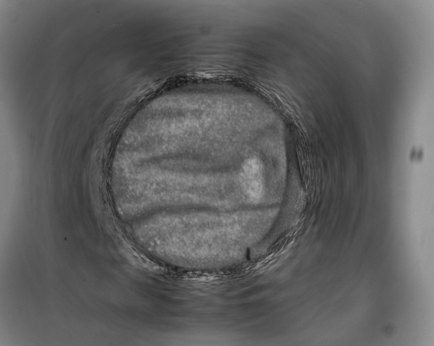 X0000099460817200805301532