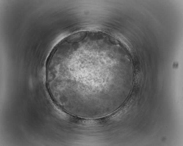 X0000099461079200805301529