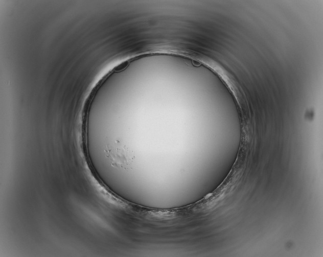 X0000099461147200805301529