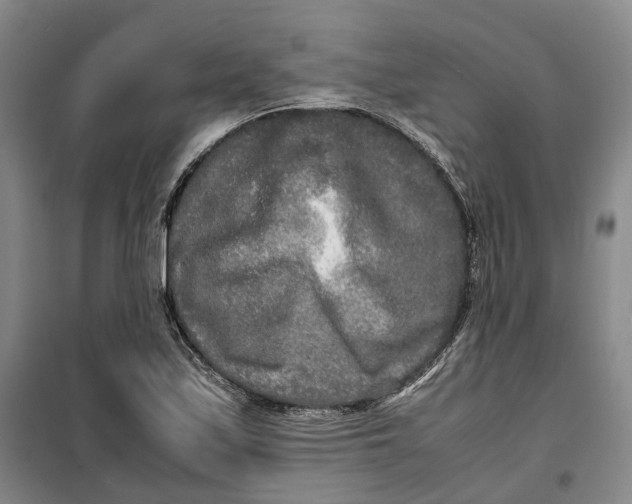 X0000099461171200805301528