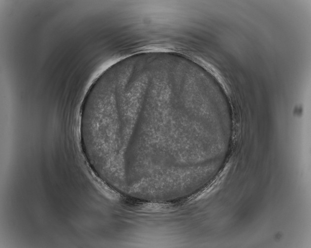 X0000099461179200805301528