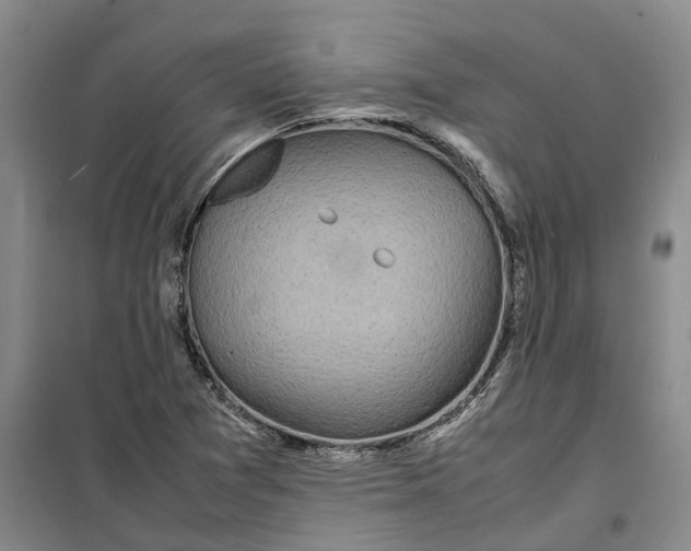 X0000099461361200805301525