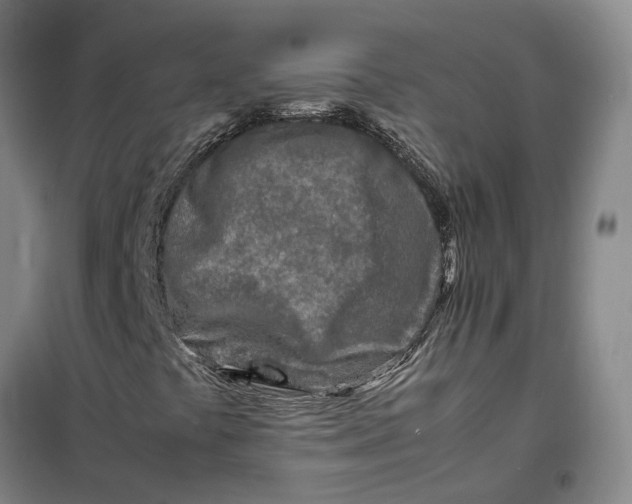 X0000099461441200805301524