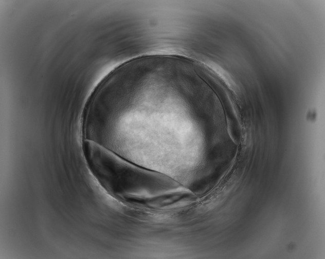 X0000099461468200805301524