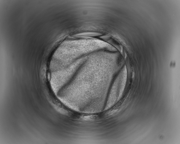 X0000099460072200806061139