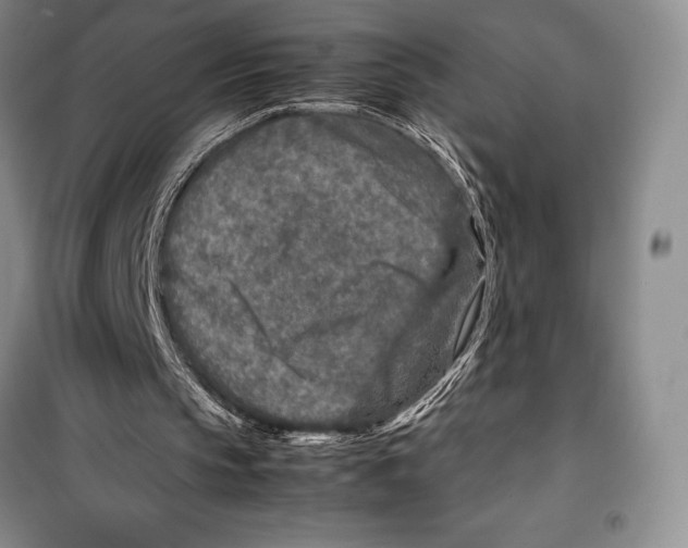 X0000099460145200806061137